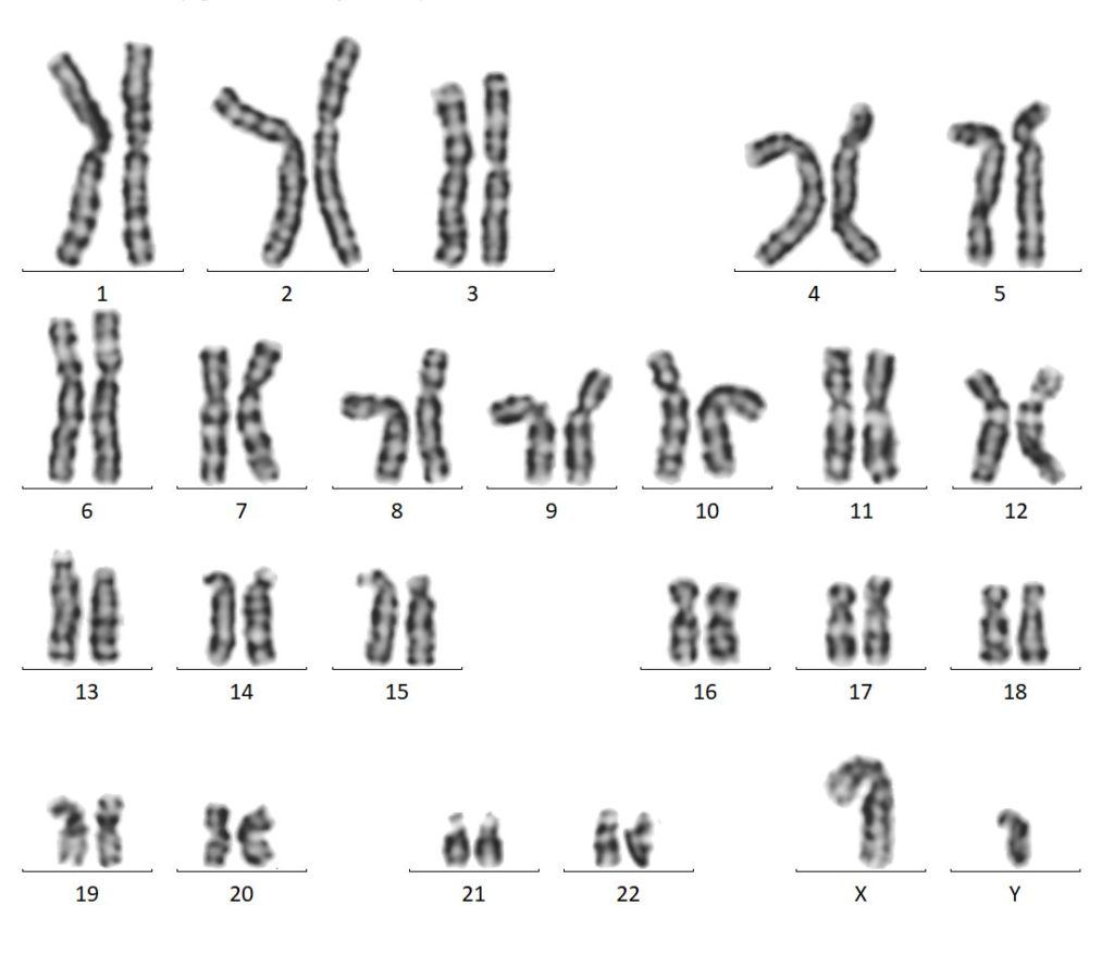Normal-Karyotype